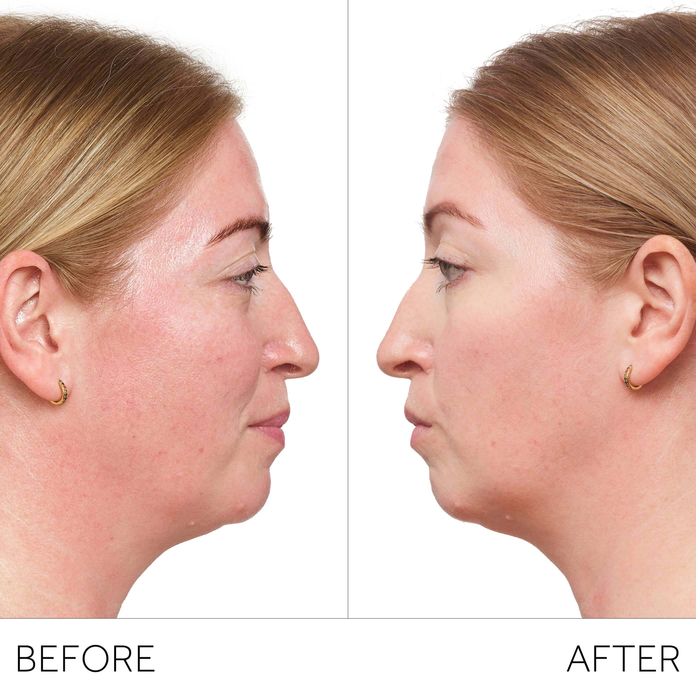 Visible results